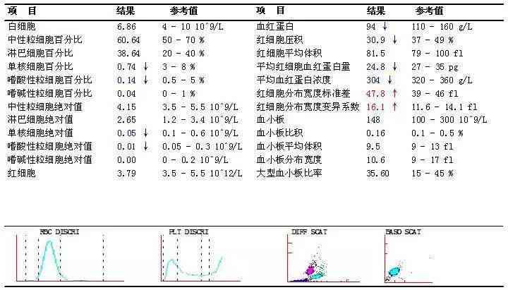 解读血常规报告单，关键指标及其意义